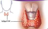 وبینار «تیروئید» در دانشگاه علوم پزشکی گیلان برگزار می شود