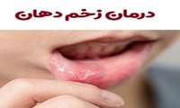 وبینار «مروری بر تازه های تشخیص و درمان زخم های دهانی» در دانشگاه علوم پزشکی گیلان برگزار می شود