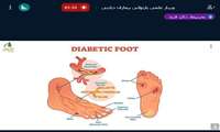 وبینار «بازتوانی بیماران دیابتی» در دانشگاه علوم پزشکی گیلان برگزار شد