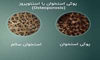 دانشگاه علوم پزشکی گیلان کنفرانس علمی یکروزه «استئوپروز از تشخیص تا درمان» را برگزار کرد