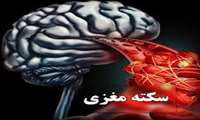 کنفرانس علمی «روش های تشخیصی و درمانی در سکته مغزی» در دانشگاه علوم پزشکی گیلان برگزار می شود