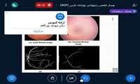 وبینار «رتینوپاتی نوزادان نارس(ROP)» در دانشگاه علوم پزشکی گیلان برگزار شد